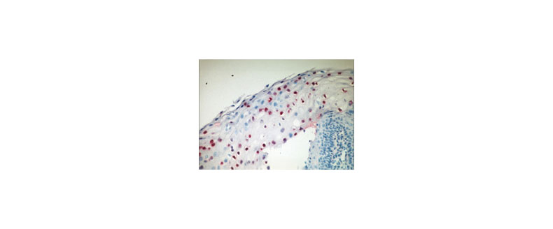 human papillomavirus